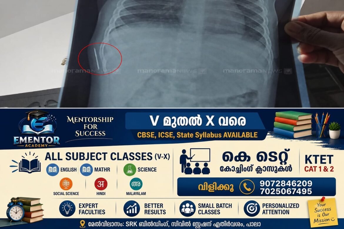 കോട്ടയം മെഡിക്കൽ കോളേജിൽ ചികിത്സാ പിഴവെന്ന് പരാതി; ഒരു വയസ്സുകാരിയുടെ ശരീരത്തിൽ സൂചി കണ്ടെത്തി